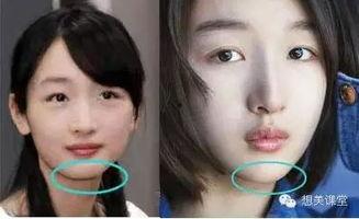 某明星下巴变长,揭秘颜值新趋势